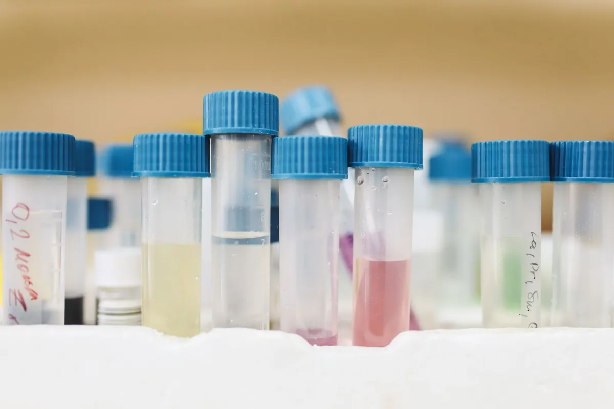 Tubos de muestras en el laboratorio clínico